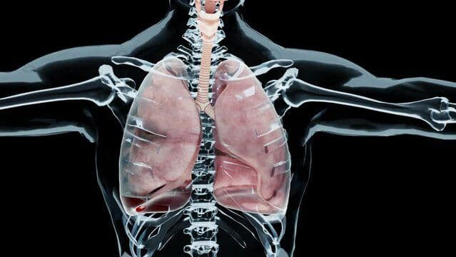 Pneumothorax Classification